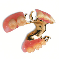 部分床義歯の写真